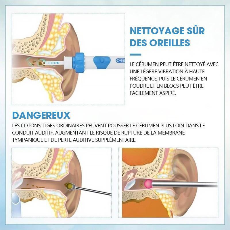 Aspirateur vibrant pour enlever le cérumen