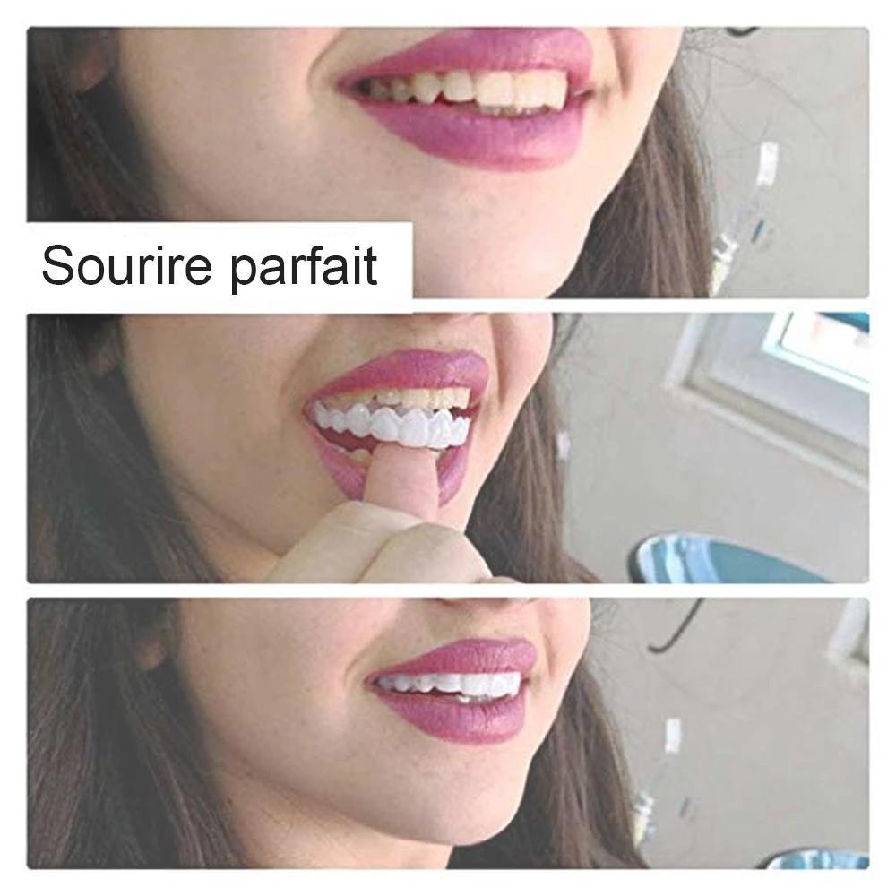 Dentier Amovible - Pour Un Sourire Plus Confiant